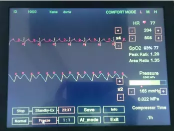 mejorado contrapulsacion externa para el tratamiento de la insuficiencia cardiaca